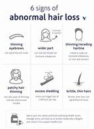 What Is Hormonal Hair Loss