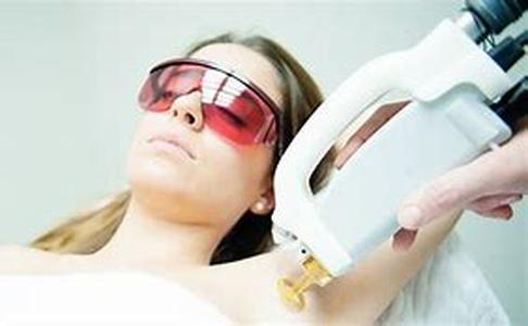 Is Laser Hair Removal An Option You Should Consider