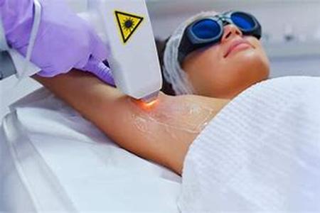 Laser Hair Removal - The Procedure