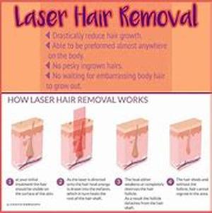 Laser Hair Removal- A Solution That's Right For You