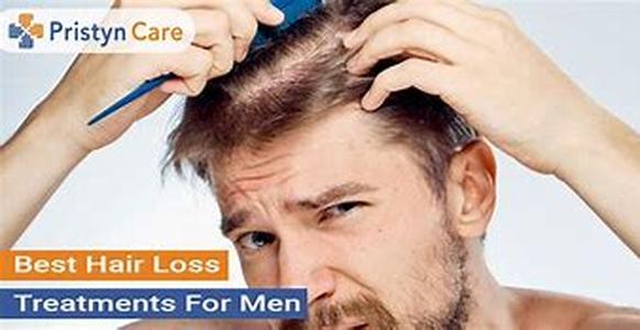 Male Hair Loss