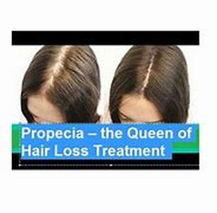 Propecia  the Queen of Hair Loss Treatment