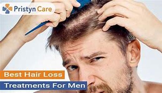 Hair Loss Treatments for men