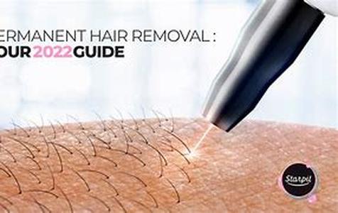 Permanent, and Less Painful: Laser Hair Removal