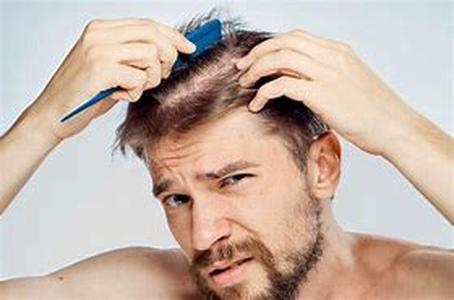 Thinning Hair Is Not A Hair Color