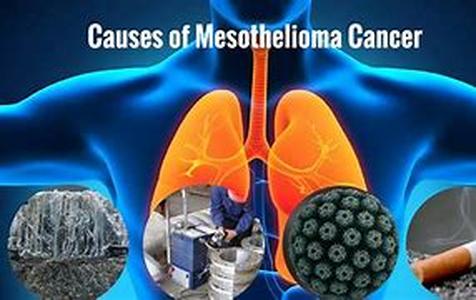 Mesothelioma Sarcoma