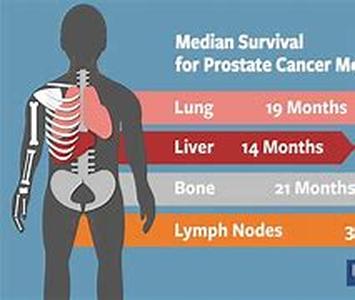 Radical Prostatectomy: A Prostate Cancer Surgery Procedure  Prostate cancer surgery may be the last thing on your mind for your disease