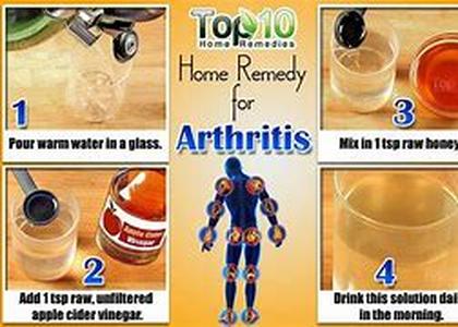 Arthritis Medication