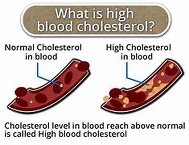 What Kills More- Cigarettes Smoking Or Obesity