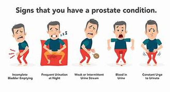 Taking Prostate Gland Health into Consideration  Prostate gland health is often overlooked