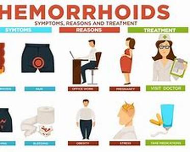 Hemorrhoids Info