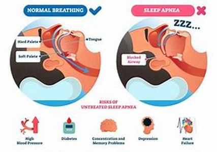 Obesity, Sexual Health and Other Health Effects