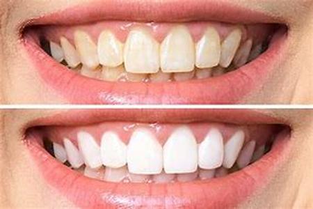 Teeth - Your options with dentists and orthodontists