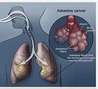 Affect of Smoking on Mothers Womb