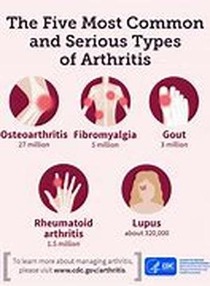 Arthritis - The Inflammatory Disease