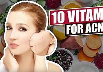 Acne Prevention - Lifestyle and Diets