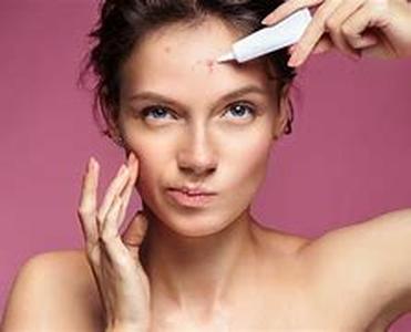 Acne: Determining what really causes Acne