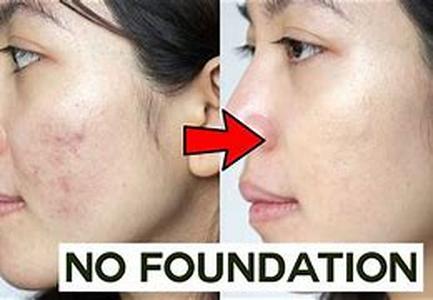 Acne Scar Solutions