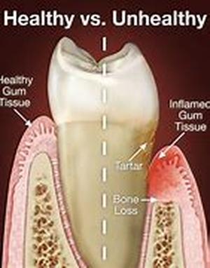 Is there a natural approach to heart disease