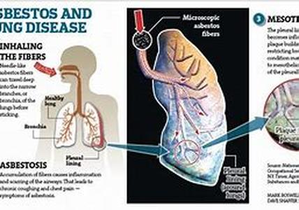 Asbestos Danger  Asbestos is a type of mineral fiber that is often used as an additive to a variety of products