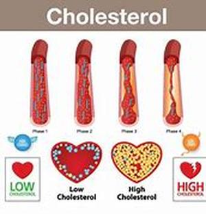 Keyword Phrase: cholesterol and heart disease