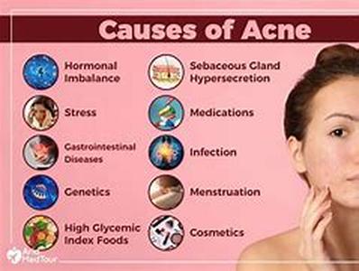 Acne: 10 Most Common Myths