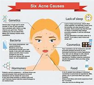 Common Acne Myths