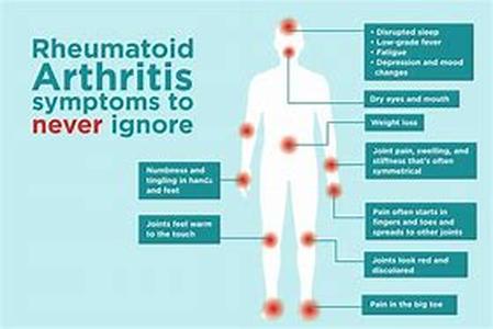 Arthritis Joint Pain