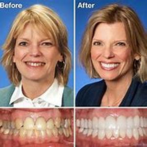 Cosmetic Dentistry - A Closer Look