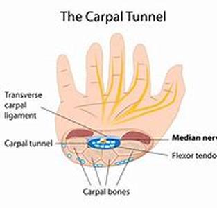 When Do You Need Carpal Tunnel Release Physical Therapy