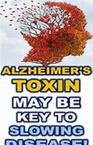 Alzheimers; The Causes And Symptoms Of Alzheimer's Disease