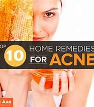 Control Acne before It Starts