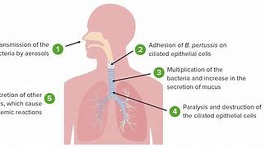 Persistent Heartburn: Get Relief Now