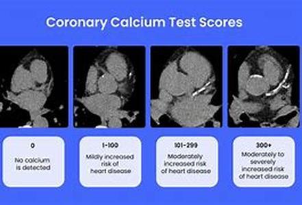 Calcium Oxide  Calx, lim, or lime