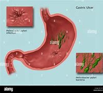 Understanding Dog Fleas: How Fleas Breed  Affect Your Dog's Health