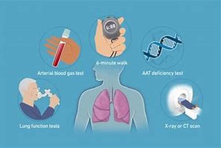 Asthma Treatment Ways