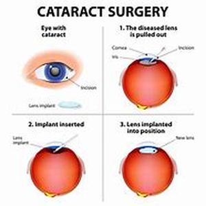 Cat Heart Disease  Summary: Cat heart disease if diagnosed earlier and treated, the chance of survival if high and may live longer