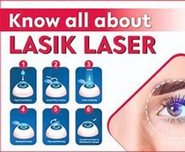 Lasik USA