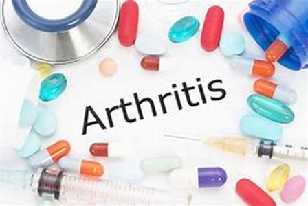 Arthritis and pain tolerance