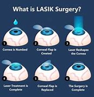 Lasik Eye Surgery