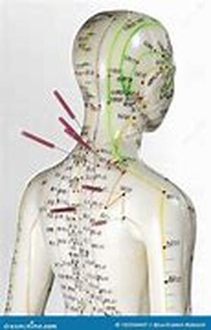 Acupuncture and Autism