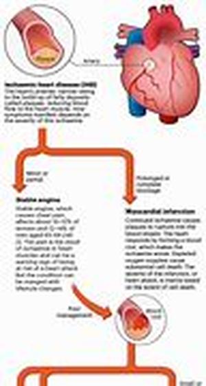 Irritable Bowel Syndrome (IBS)  A Functional Disorder