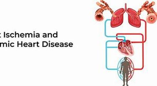 Sick Sinus Syndrome in Heart Disease