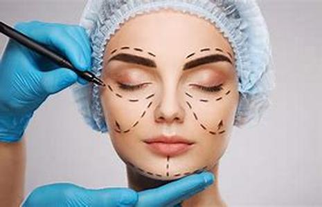 Cosmetic Surgery:Is It For You