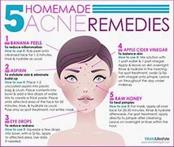 Acne Surgery