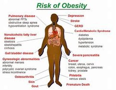 Obesity and Binge Eating