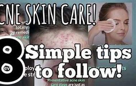 Acne Skin Care