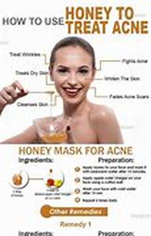 Acne Cures And Myths