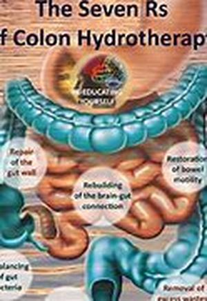 Colon Cancer