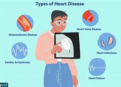 Heart Disease and Exercise  Summary: There are several ways that you can do to avoid heart disease and exercise is one of them